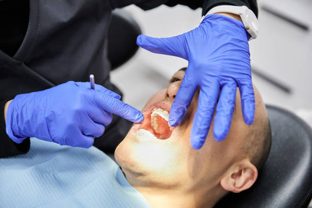 Best Weekend Emergency Dentist in Mercer Island, WA